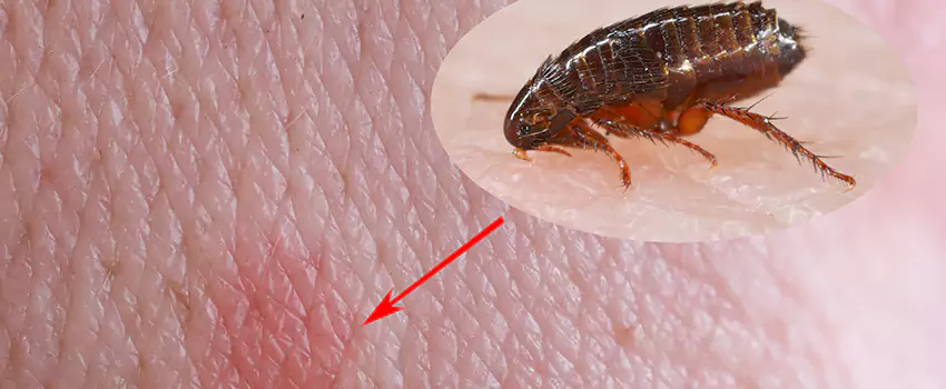 Flea Control for Humans Whittier, CA